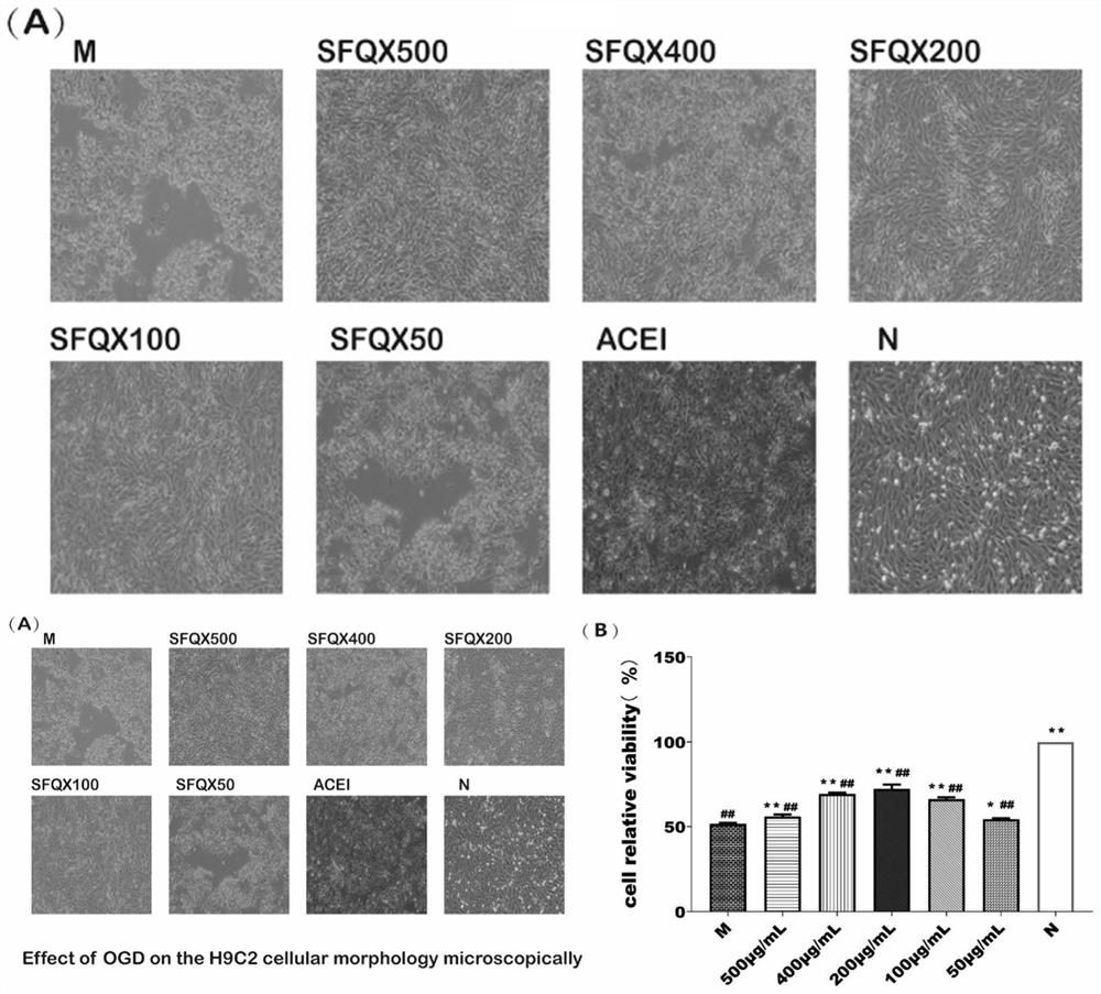 Application of ginseng-radix aconiti lateralis praeparata heart-strengthening pill in promotion of myocardial cell autophagy