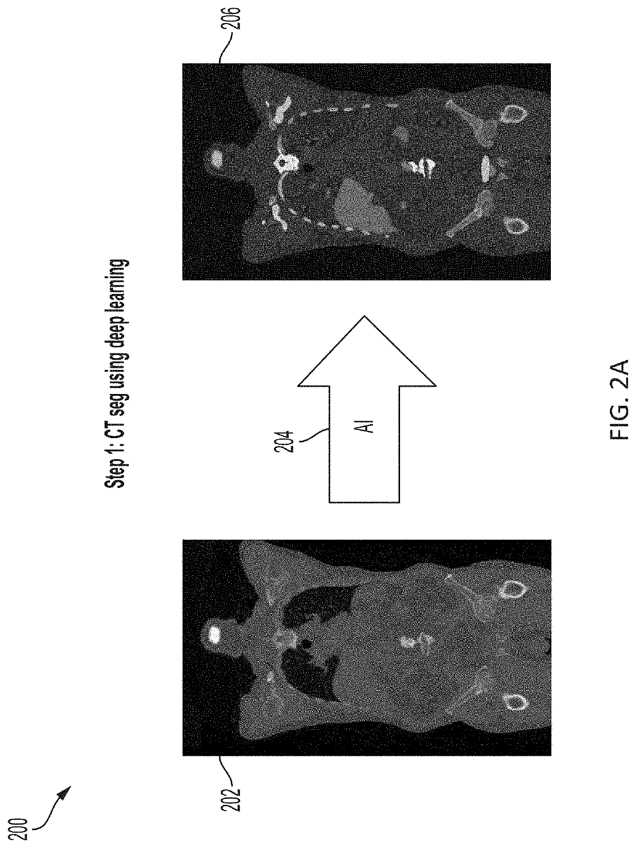 Systems and methods for artificial intelligence-based image analysis for cancer assessment