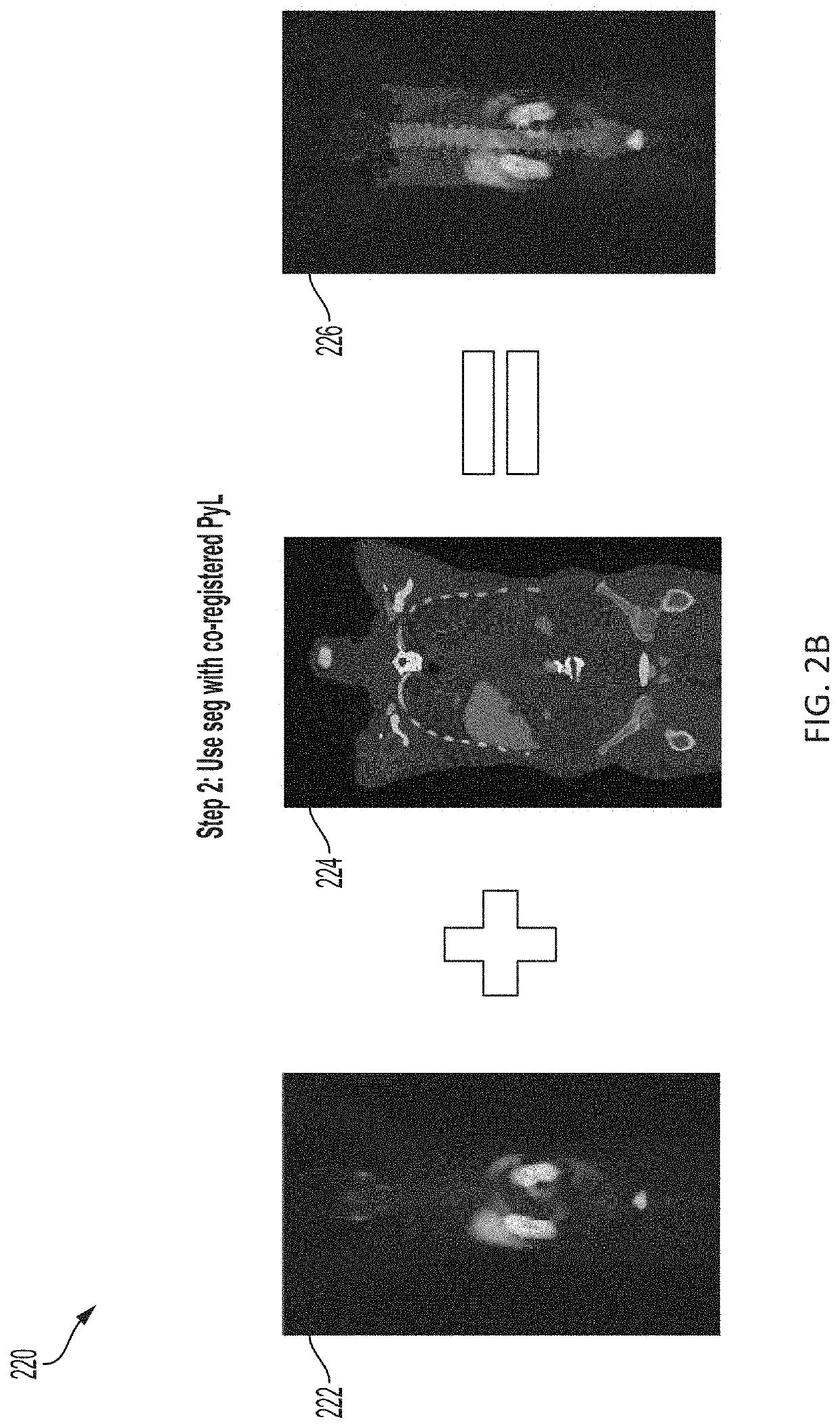 Systems and methods for artificial intelligence-based image analysis for cancer assessment