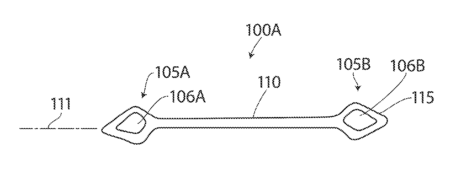 Systems and methods for treatment of sleep apnea