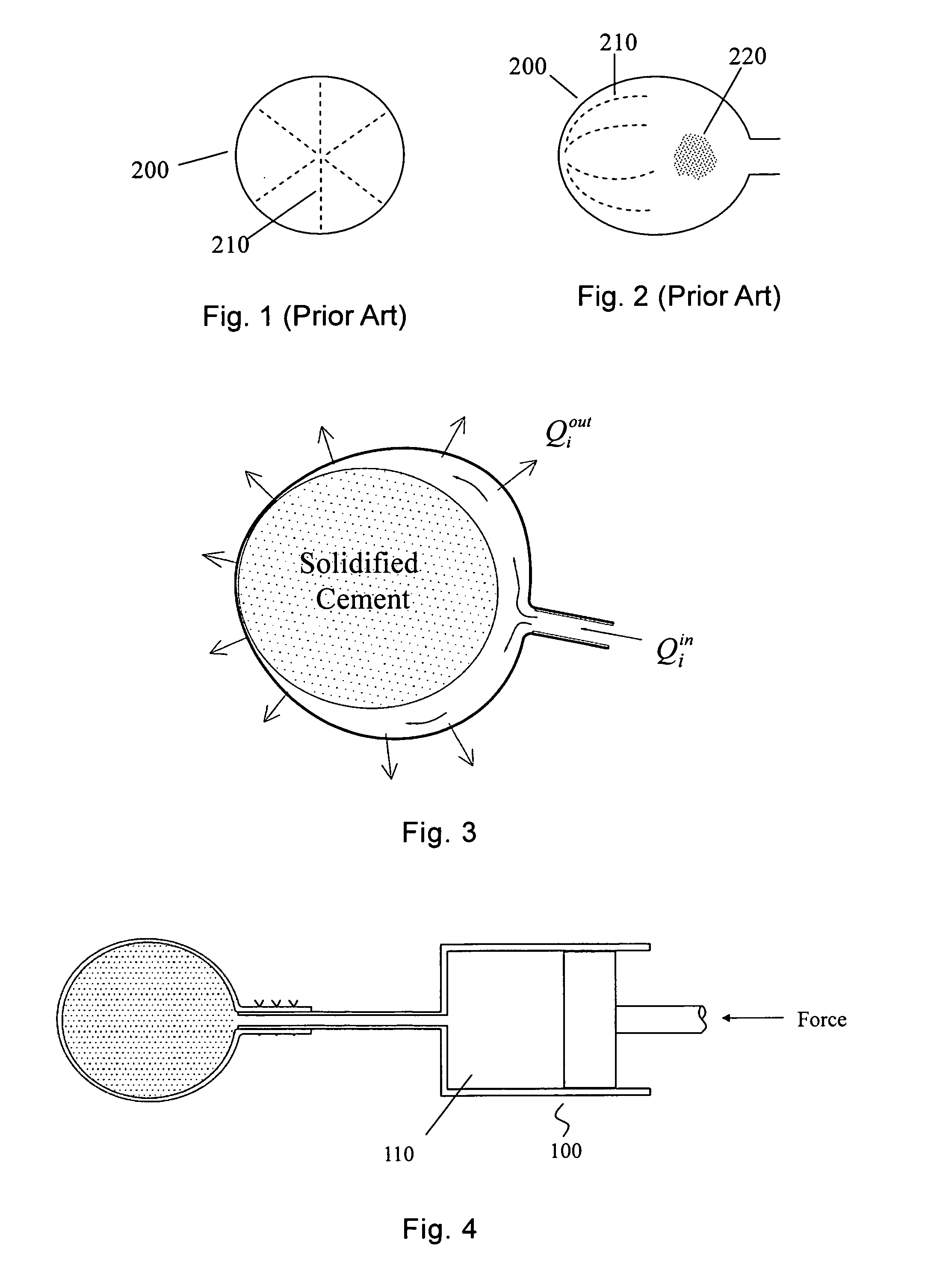 Method for forming a bioresorbable composite implant in a bone