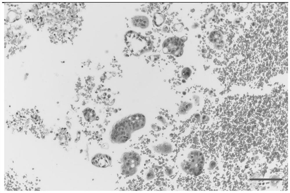 Culture medium for culturing primary cells related to cholecystic cholangiocarcinoma