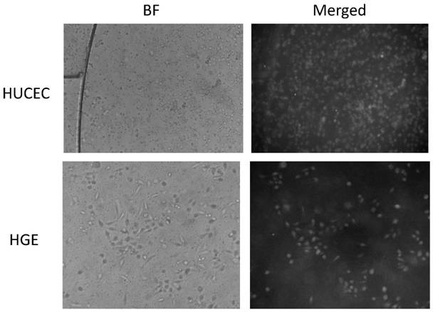 Periodontal soft tissue bionic chip constructed on basis of microfluidic technology and application of periodontal soft tissue bionic chip