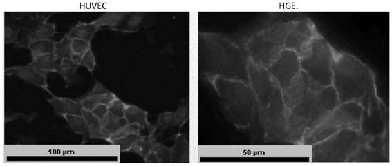 Periodontal soft tissue bionic chip constructed on basis of microfluidic technology and application of periodontal soft tissue bionic chip