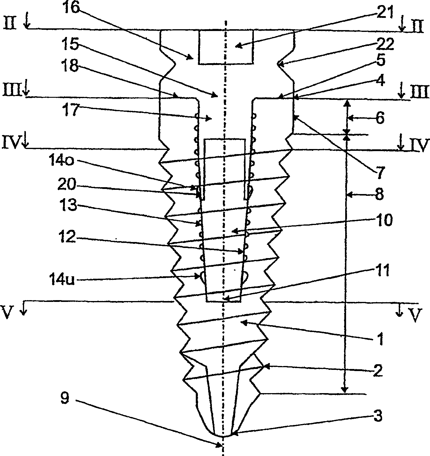 Post-shaped element for determining spatial position