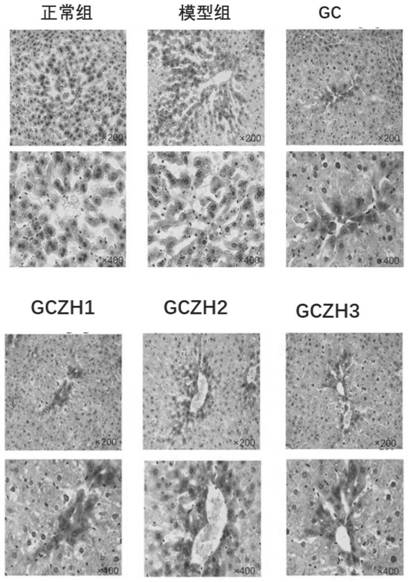 Application of 3'-geranyl citrus chalcone and composition in preparing products for treating fatty liver