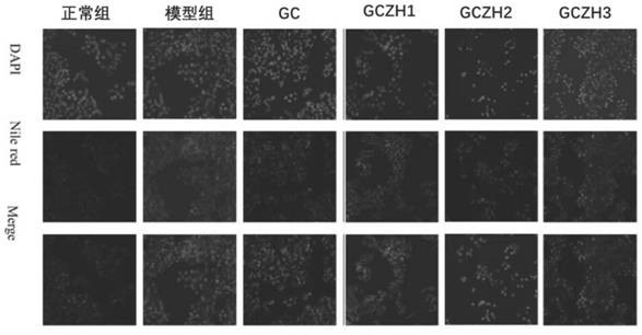 Application of 3'-geranyl citrus chalcone and composition in preparing products for treating fatty liver