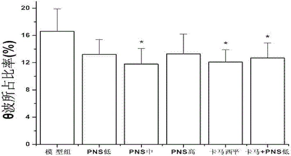 A kind of antiepileptic drug, its preparation method and application