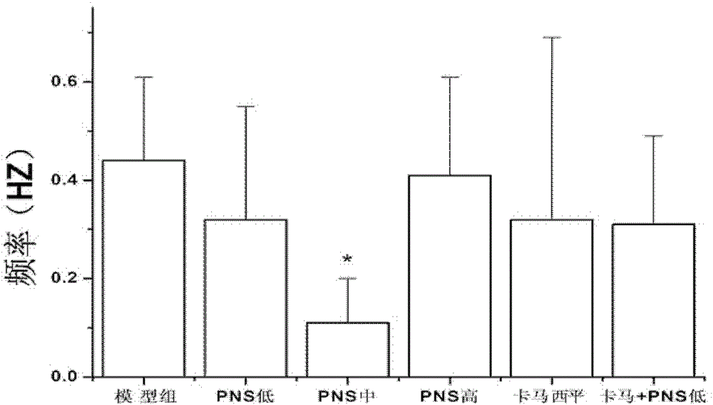 A kind of antiepileptic drug, its preparation method and application