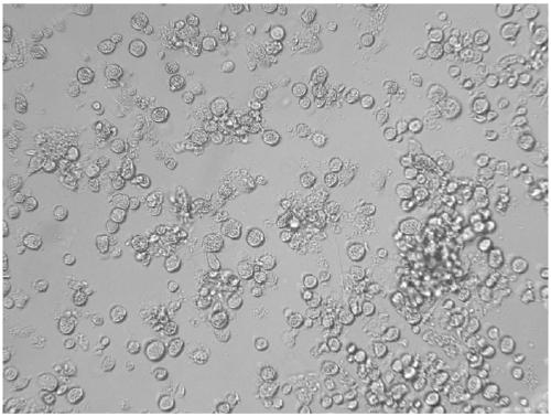 Preparation method of human DC (dendritic cell) tumor vaccine