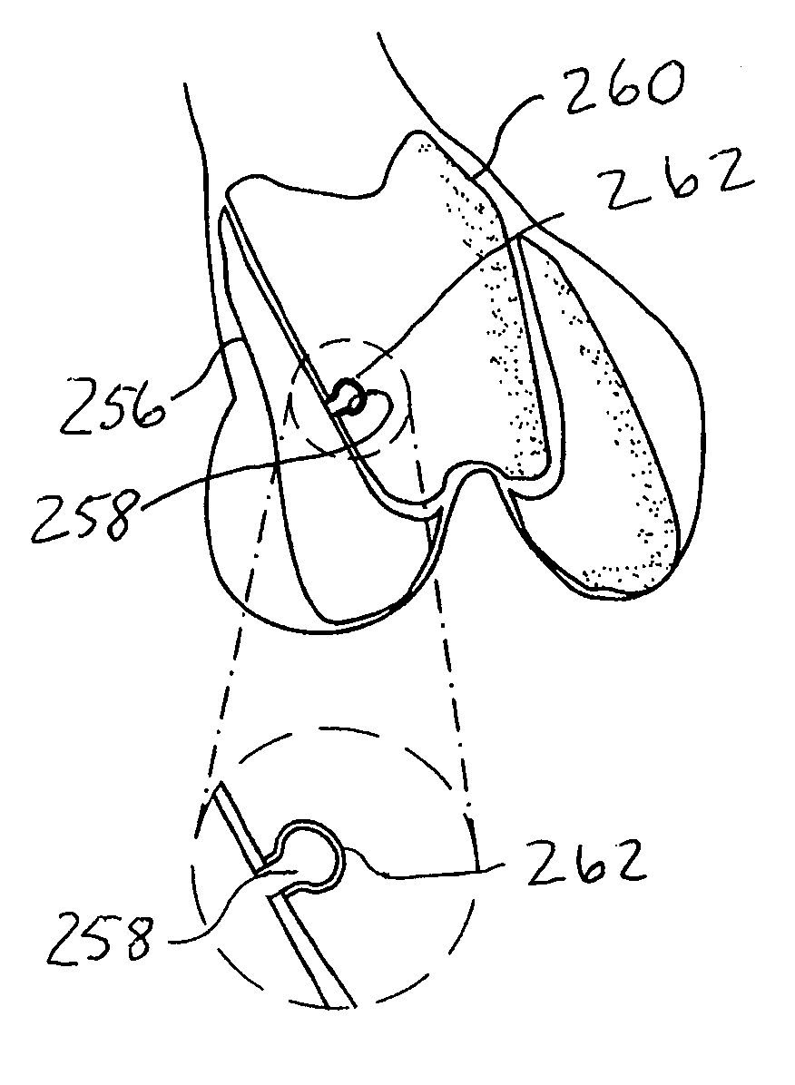 Systems and methods for compartmental replacement in a knee