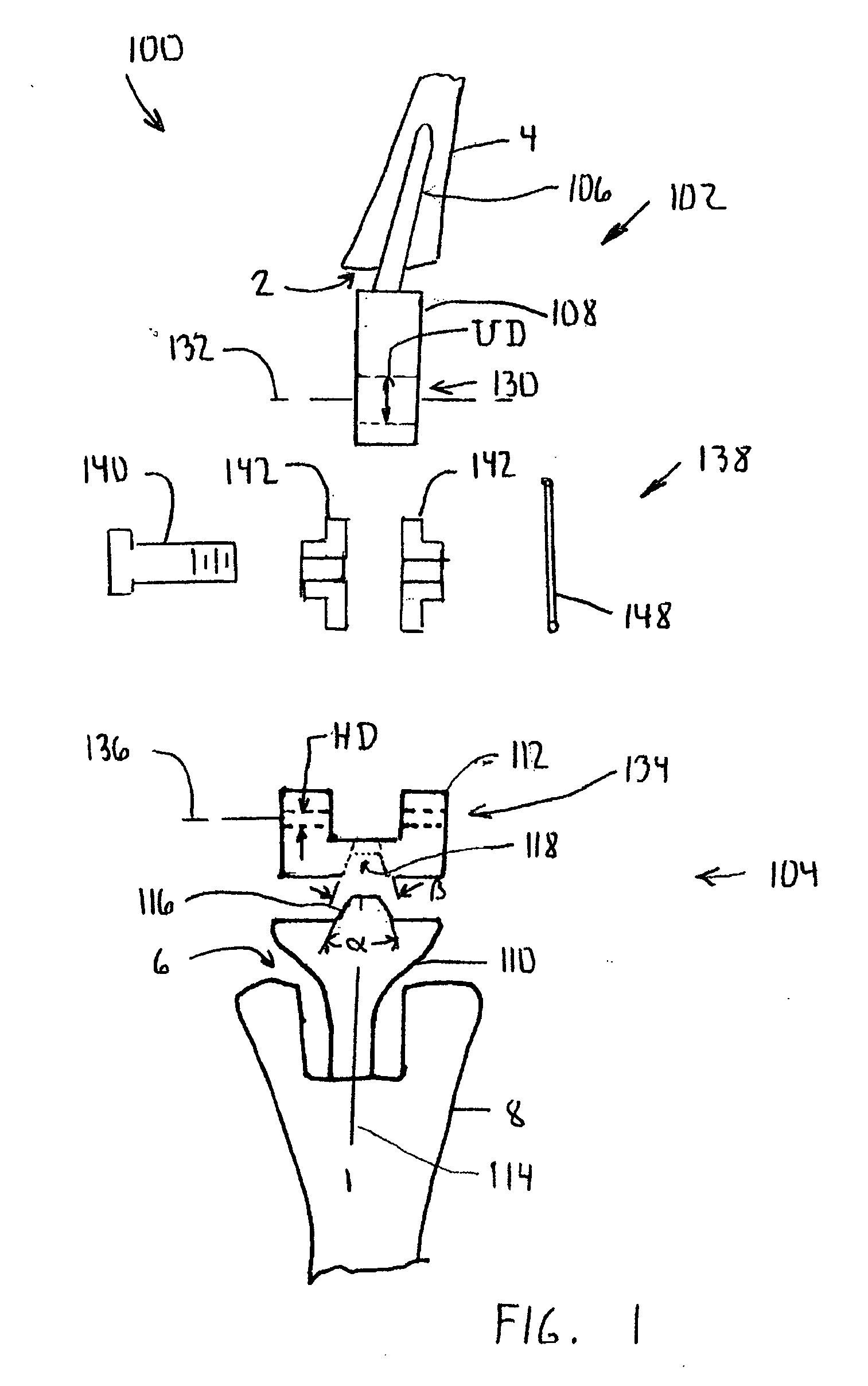 Mobile bearing total elbow prosthesis, humeral component, and associated method