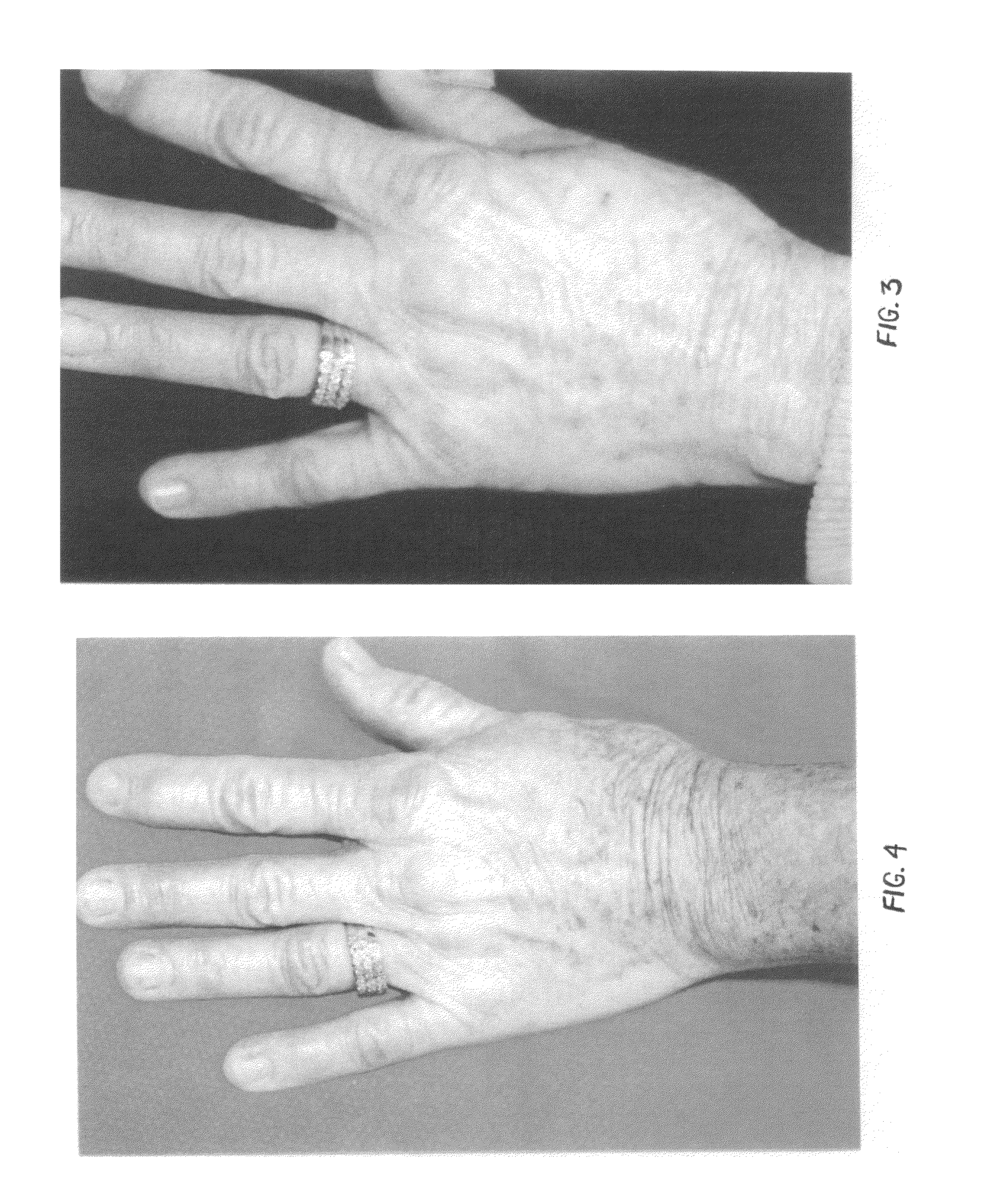 Topical compositions for anti-aging and methods of using same