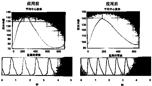 Nitric oxide donor traditional Chinese medicine compound preparation as well as preparation method and application thereof