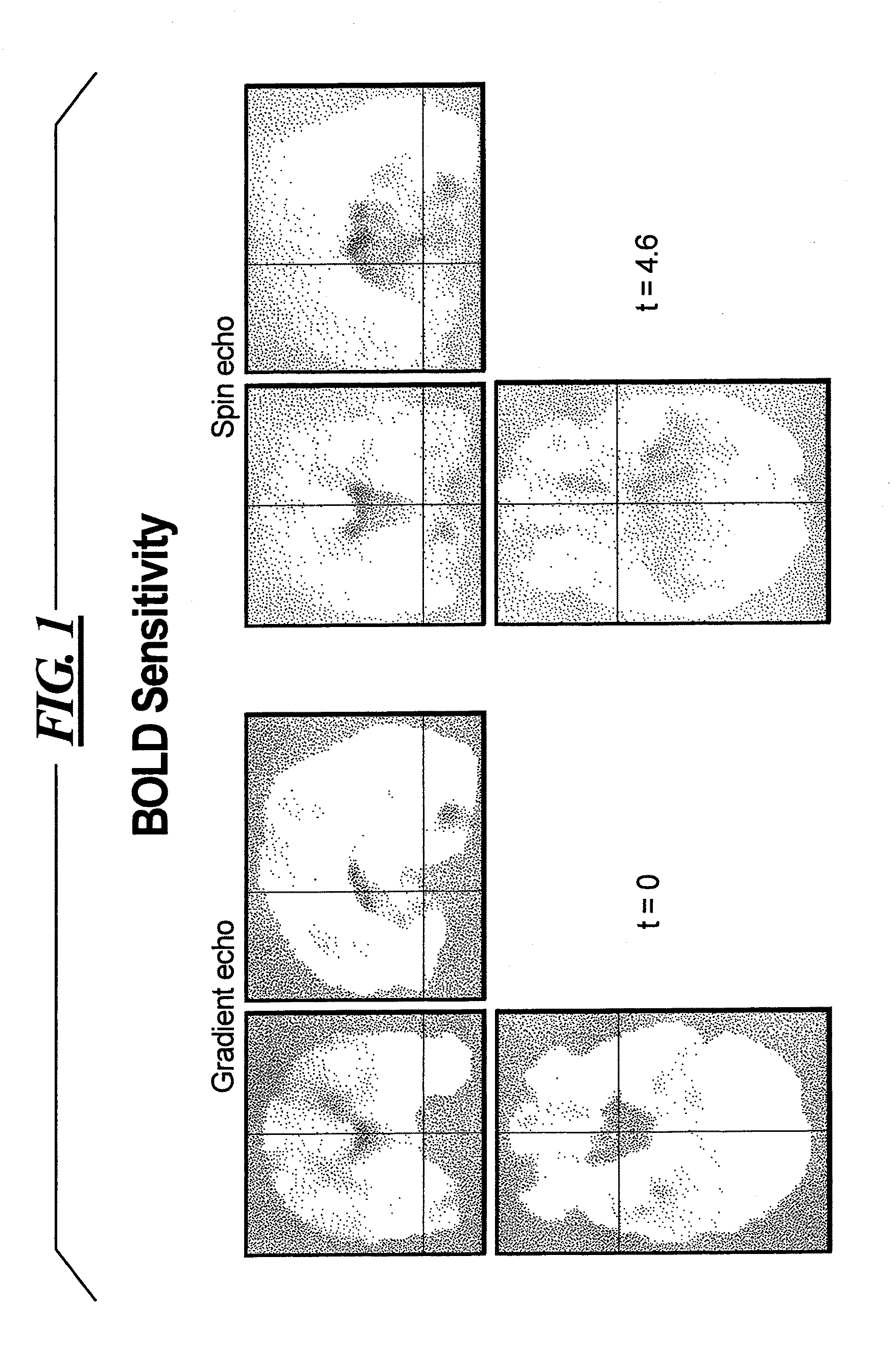 Magnetic resonance method and apparatus using dual echoes for data acquisition