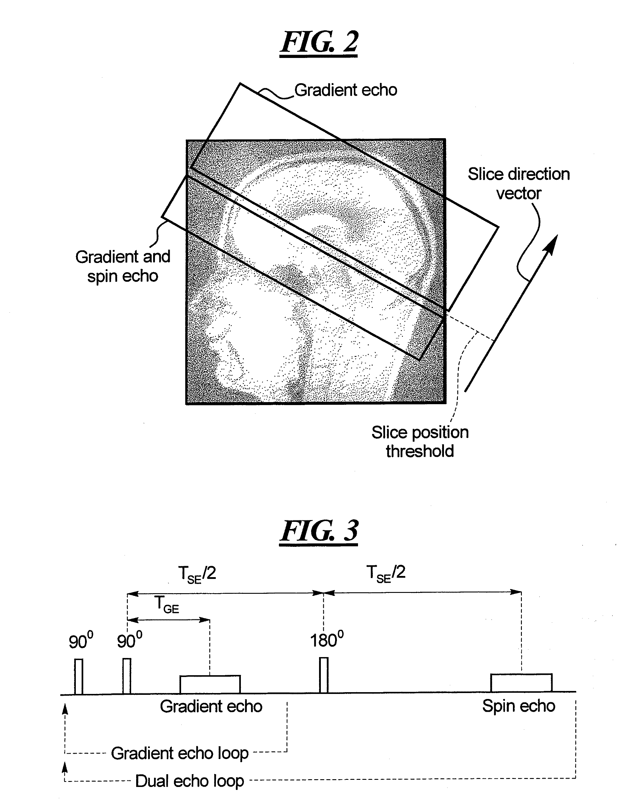 Magnetic resonance method and apparatus using dual echoes for data acquisition