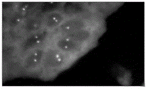 ERG gene detection probe, preparation method thereof and reagent kit