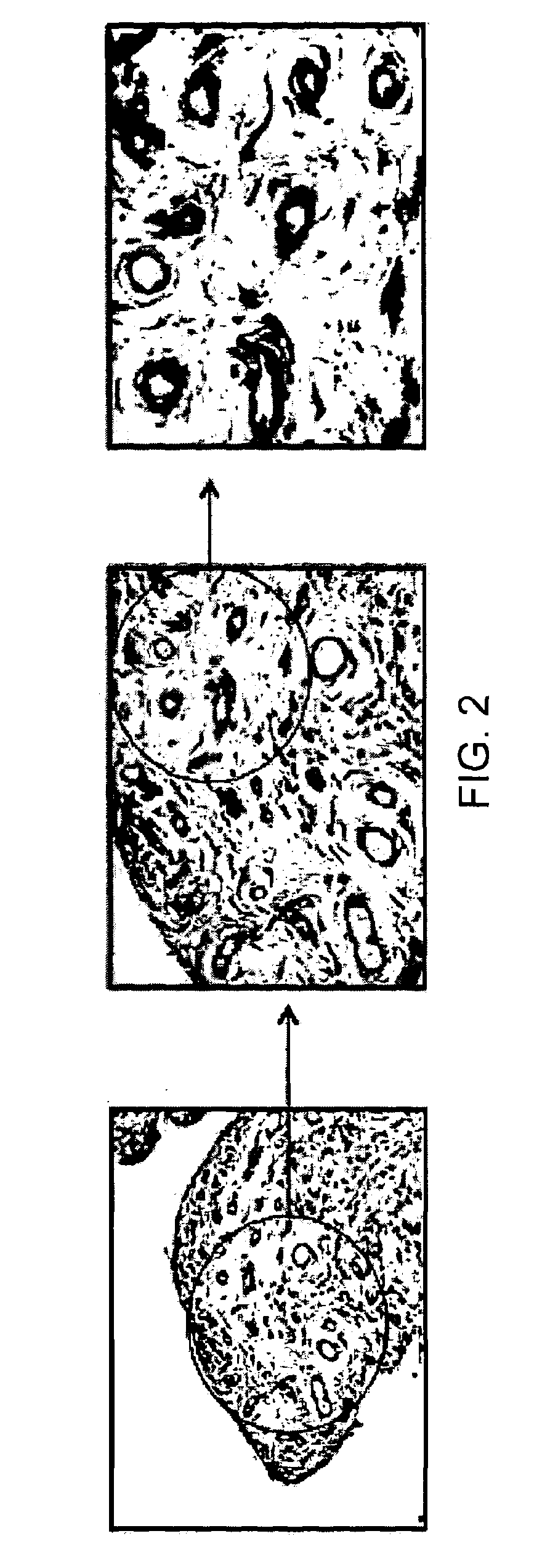 Antibody specifically binding synovial microvasculature of arthritis patients