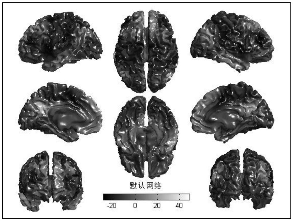 A device for predicting the state of consciousness of the human brain