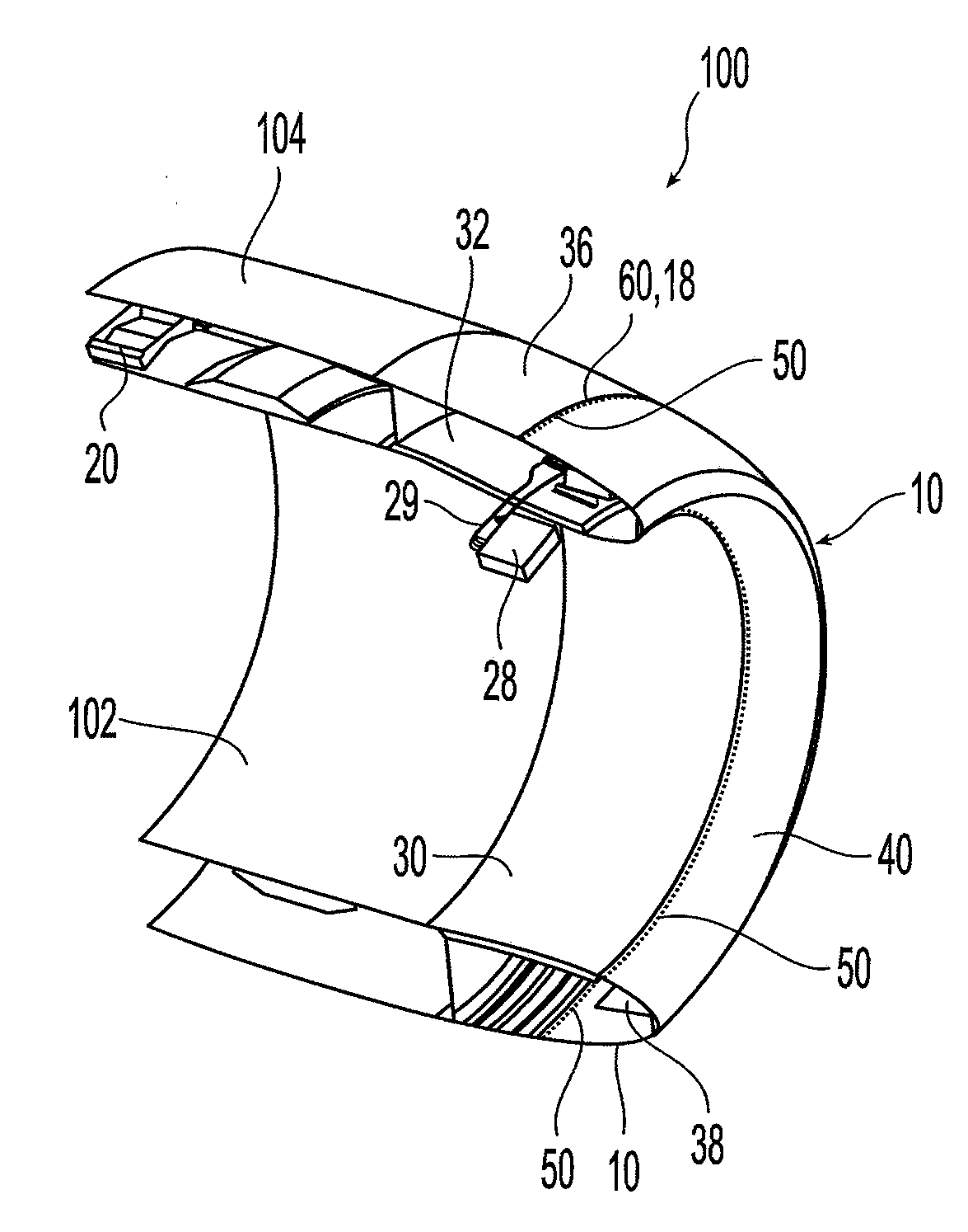 Aircraft engine nacelle inlet having access opening for electrical ice protection system