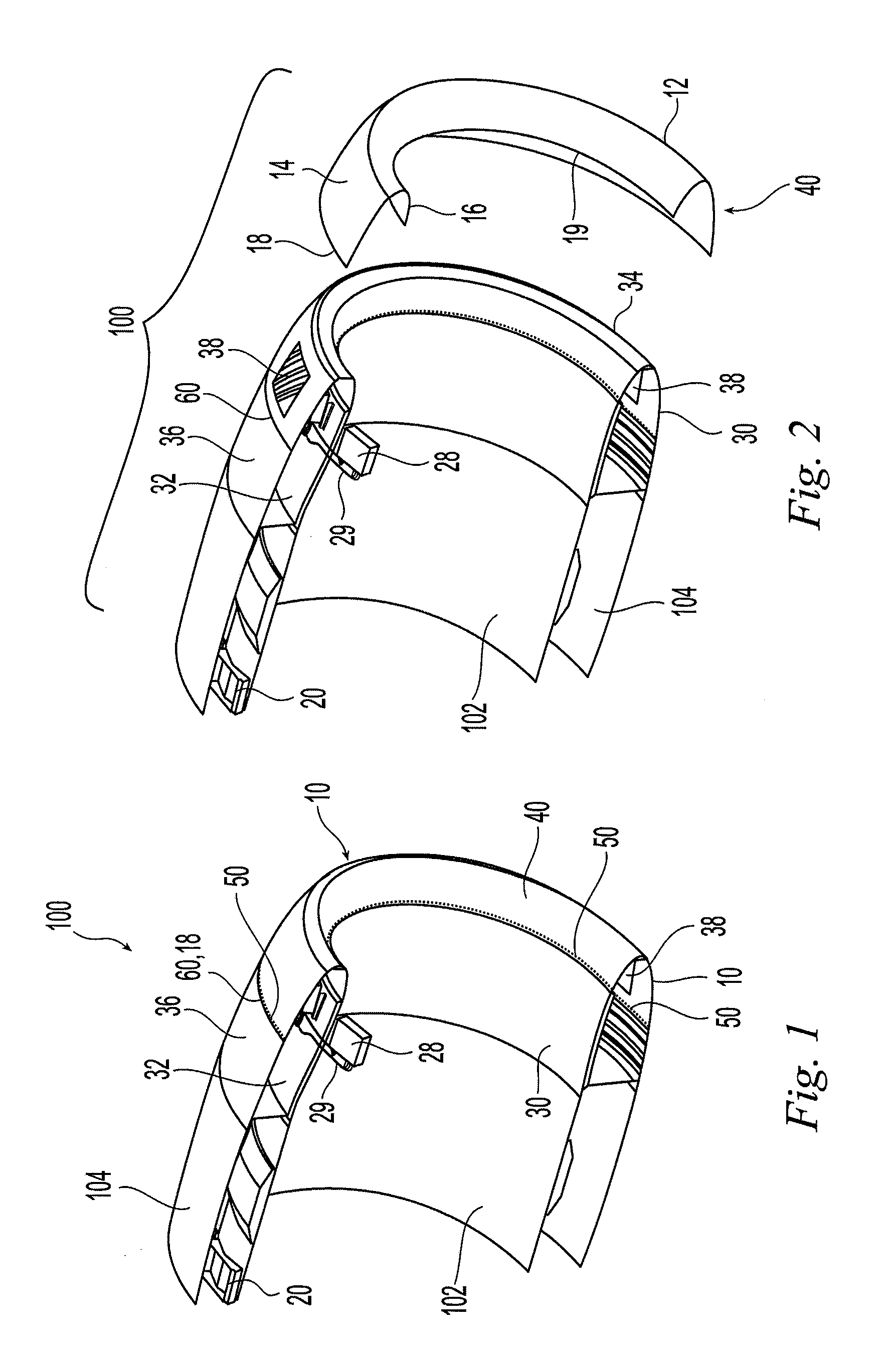 Aircraft engine nacelle inlet having access opening for electrical ice protection system