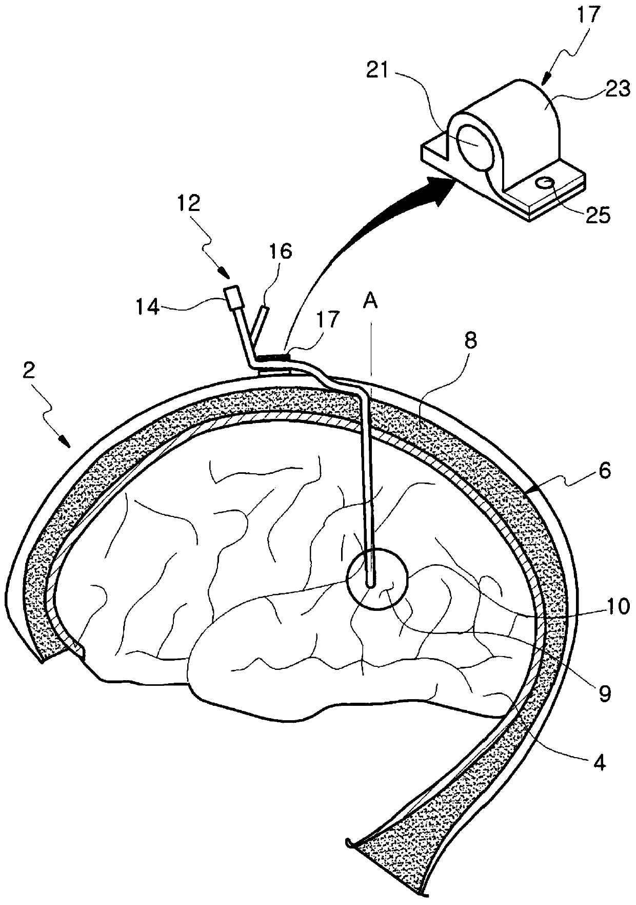 cranial catheter device