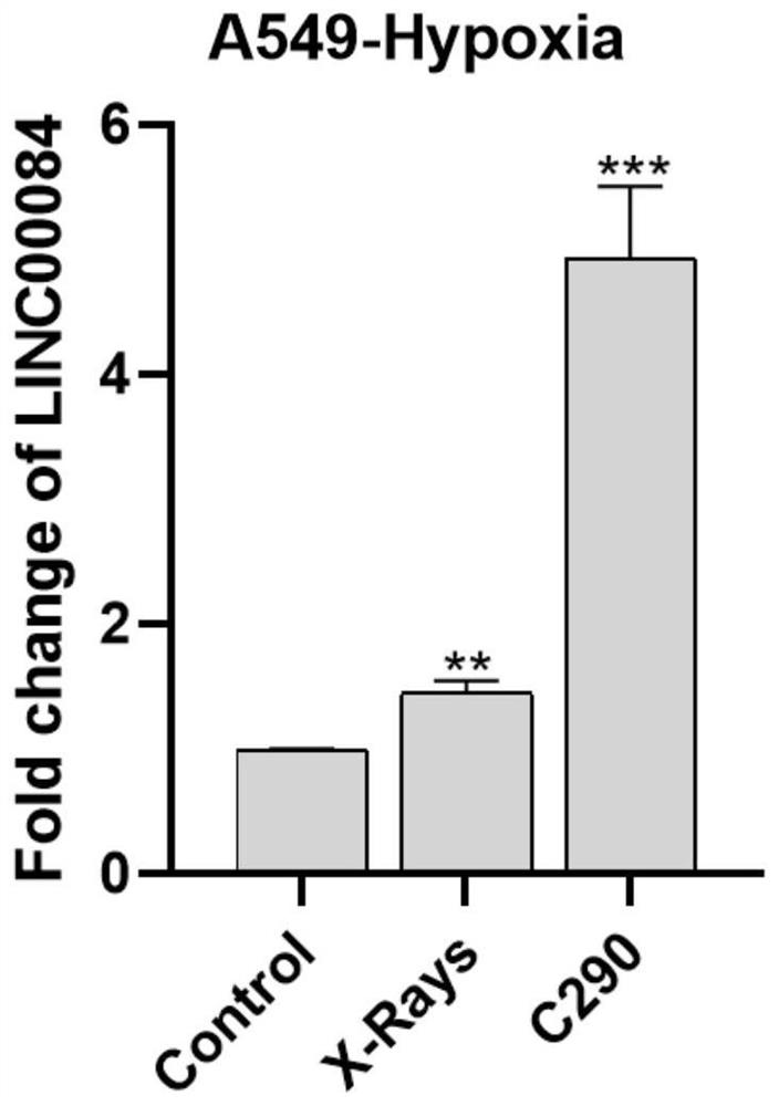 Application of linc00084 in the preparation of adjuvant drugs for hypoxic tumor radiotherapy