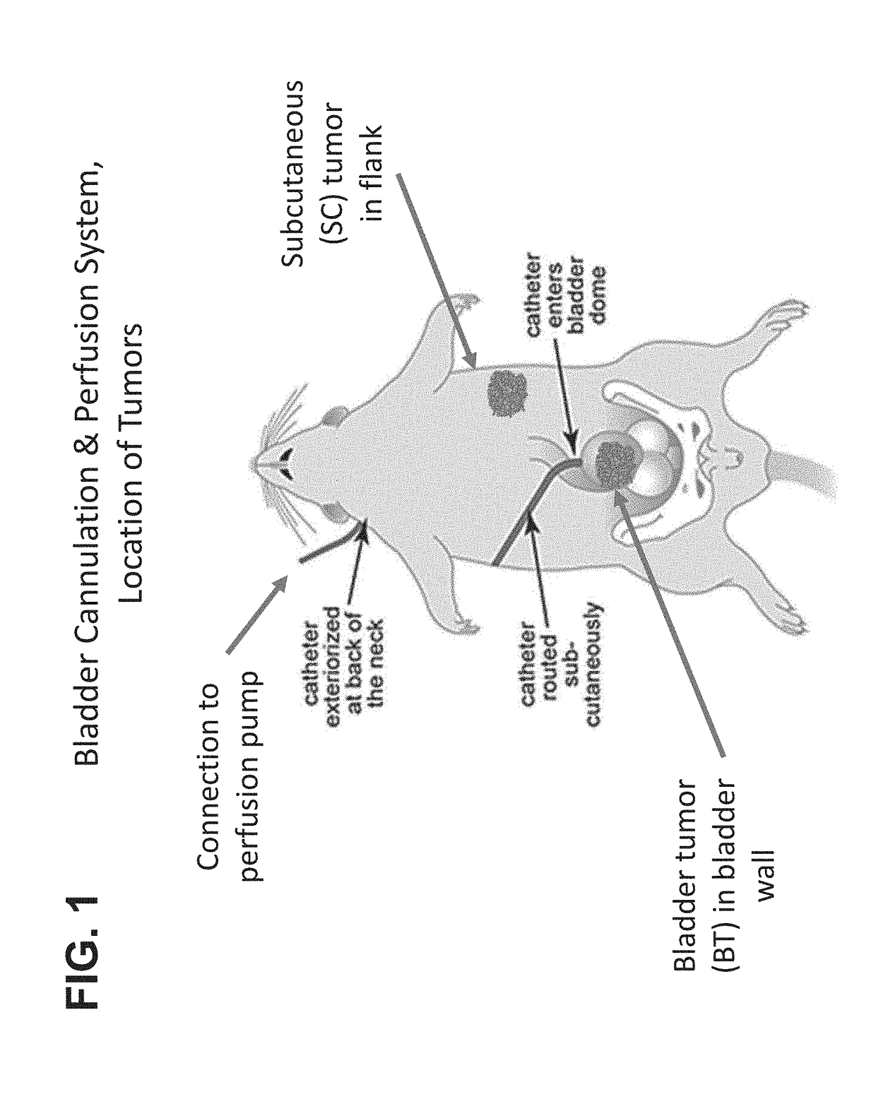 Methods of treating tumor metastasis