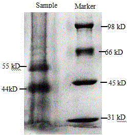 Affinity chromatography medium for separating and purifying GABA receptor and preparation method thereof