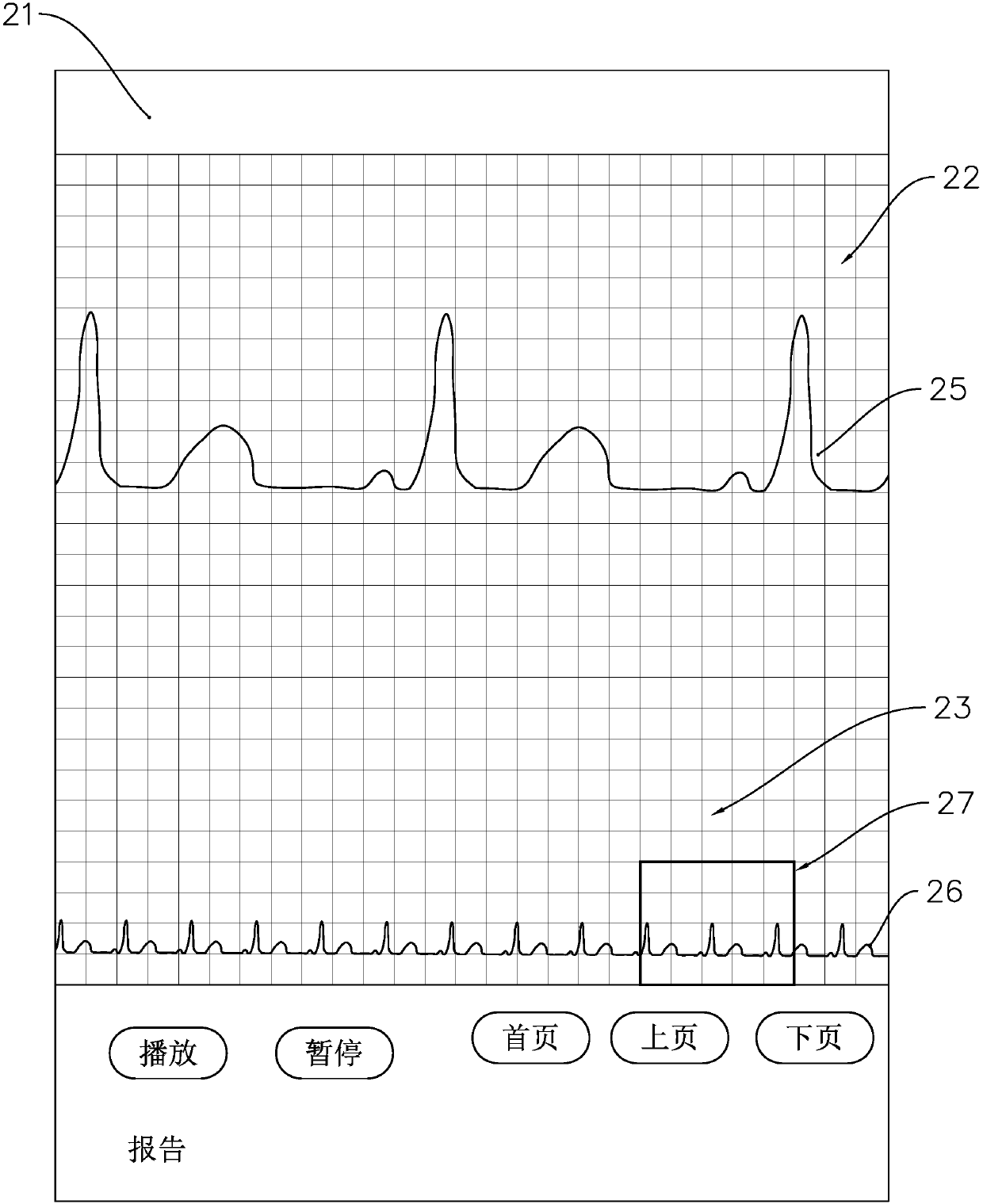 ECG (electrocardiogram) display method, computer device and computer readable storage medium