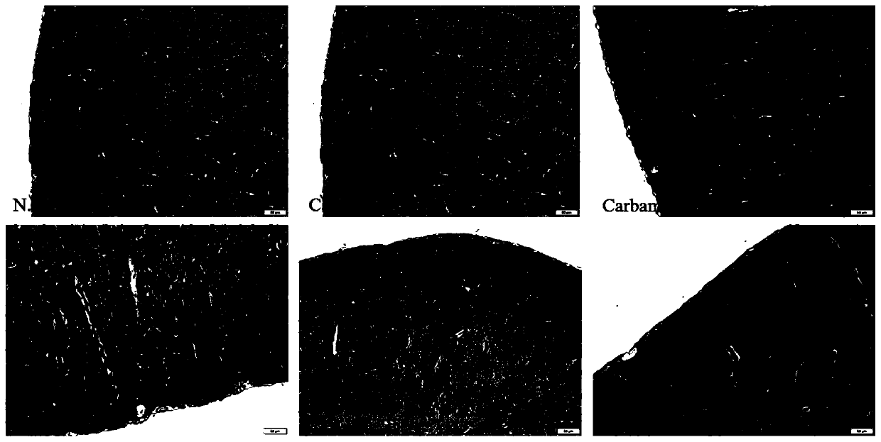 A kind of pharmaceutical composition containing carbamazepine and biotin and application thereof