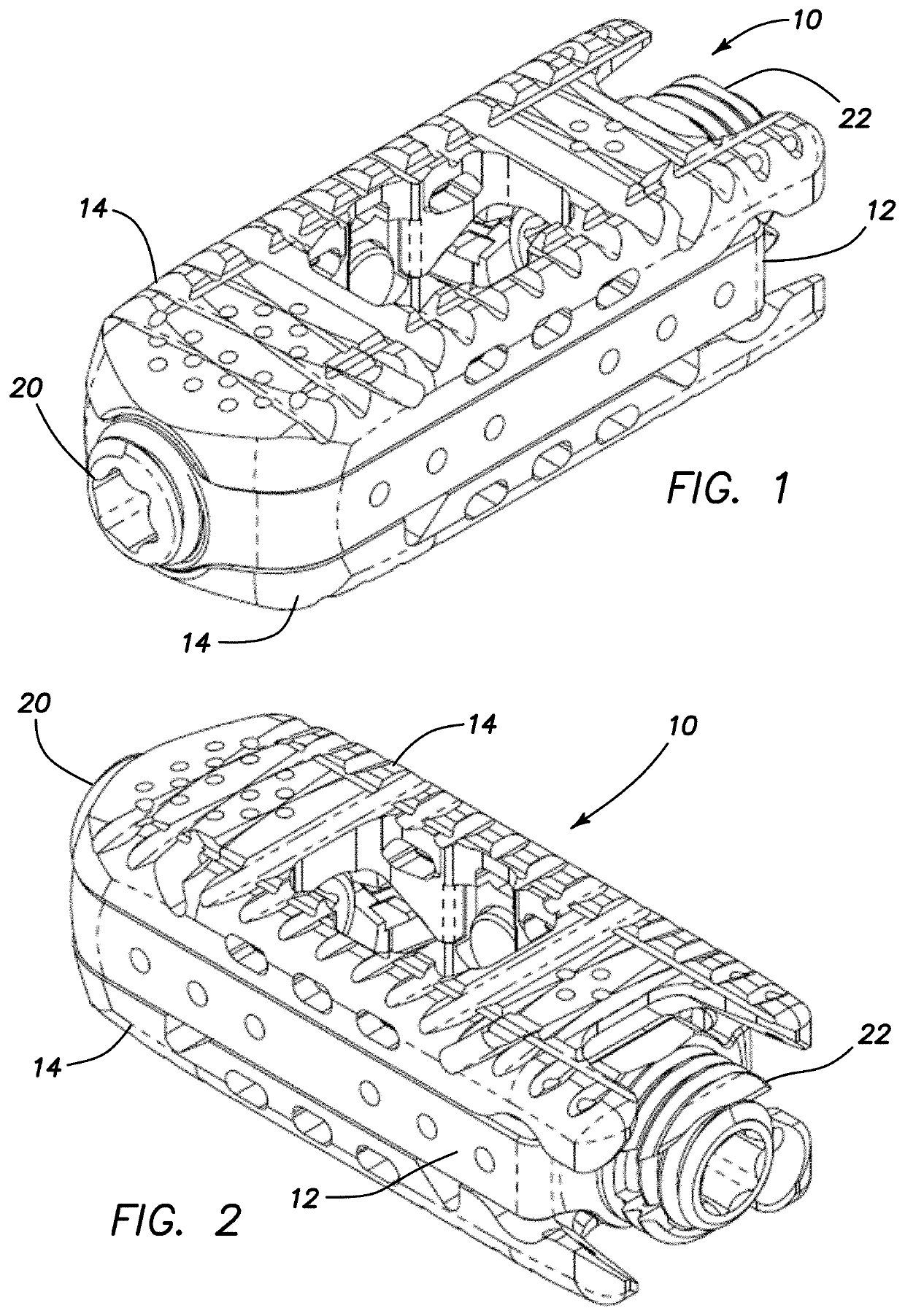 Expandable interbody spacer