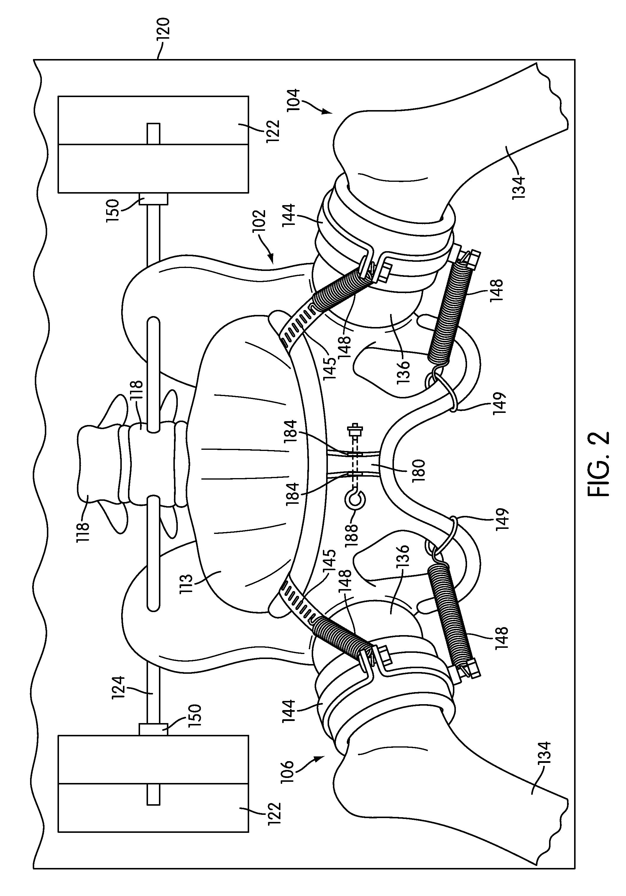 Brachial plexus simulator