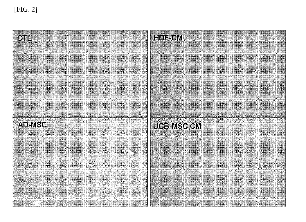 Composition Including GDF11 and Use Thereof