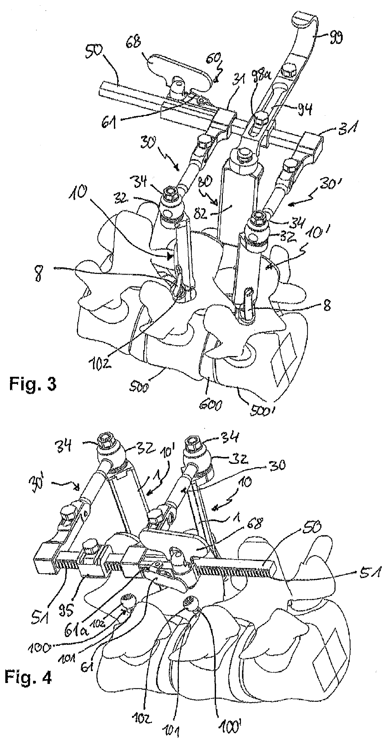 Instrument for attaching to a bone anchor and instrument for use in distraction and/or retraction, in particular for orthopedic surgery or neurosurgery, more specifically for spinal surgery