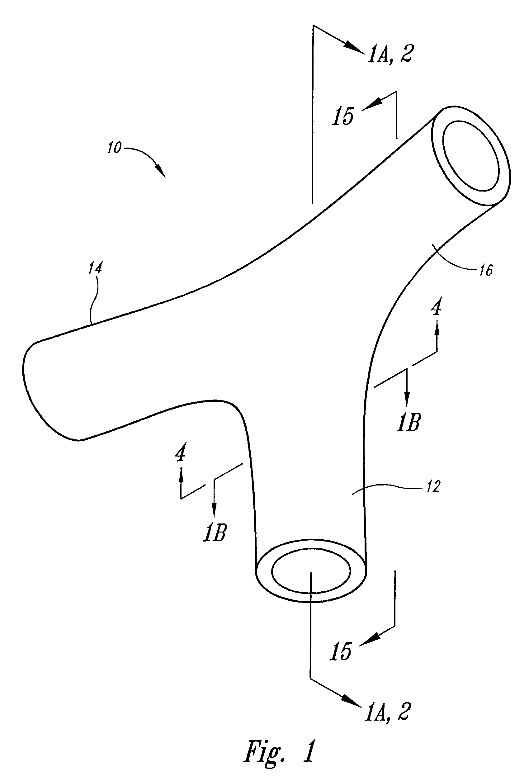 Vascular anchoring system and method