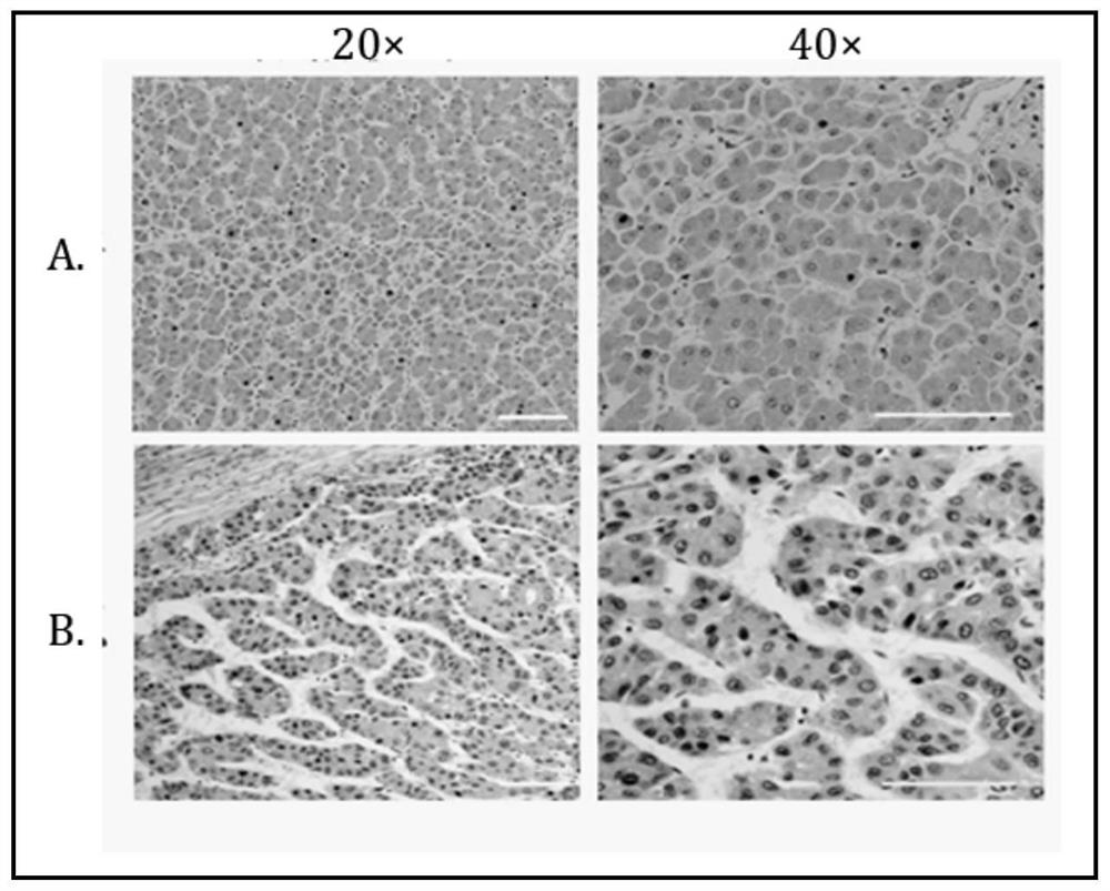 Hybridoma cell, monoclonal antibody against human cyclophilin a and application thereof