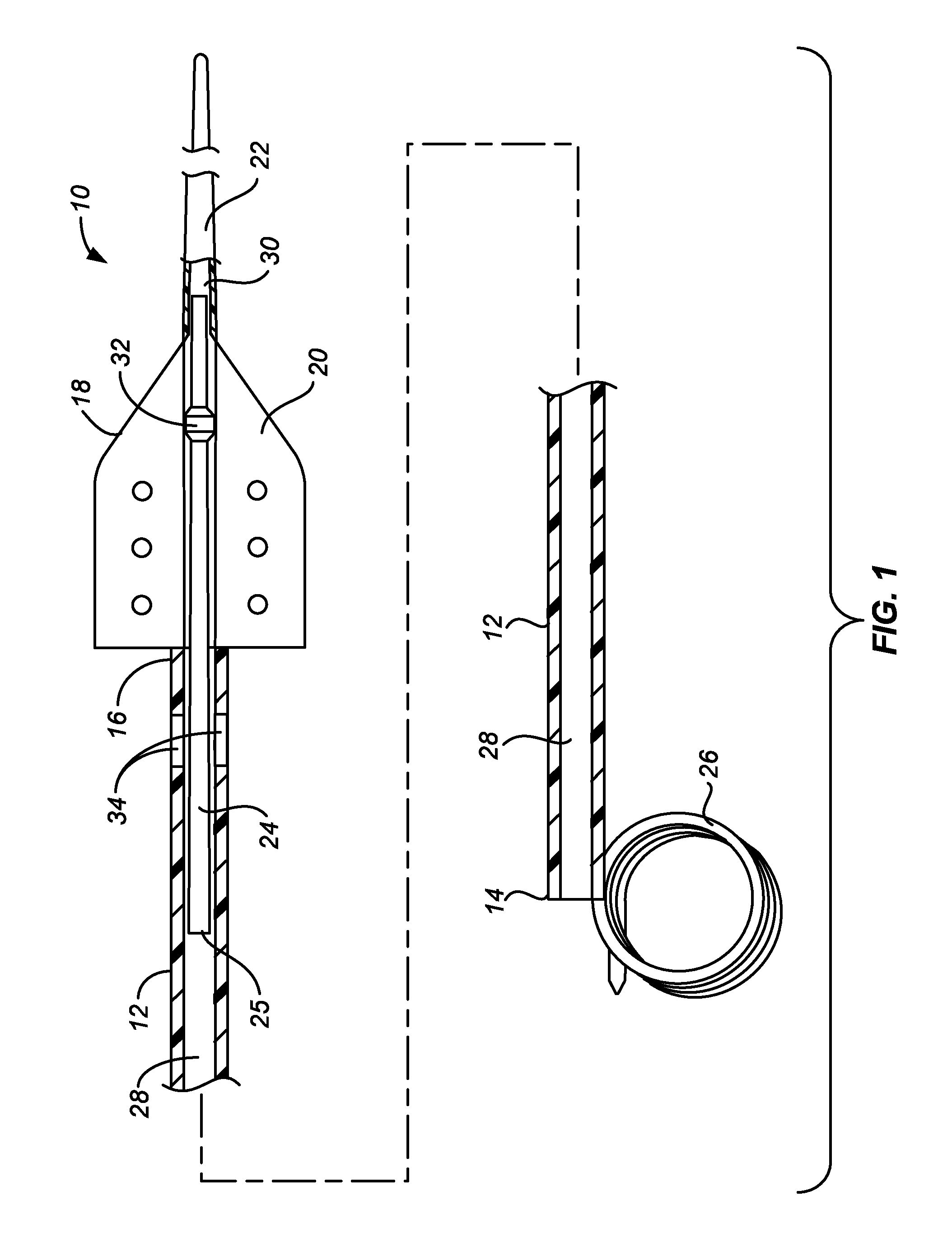 Ureteral stent and method and system for its deployment