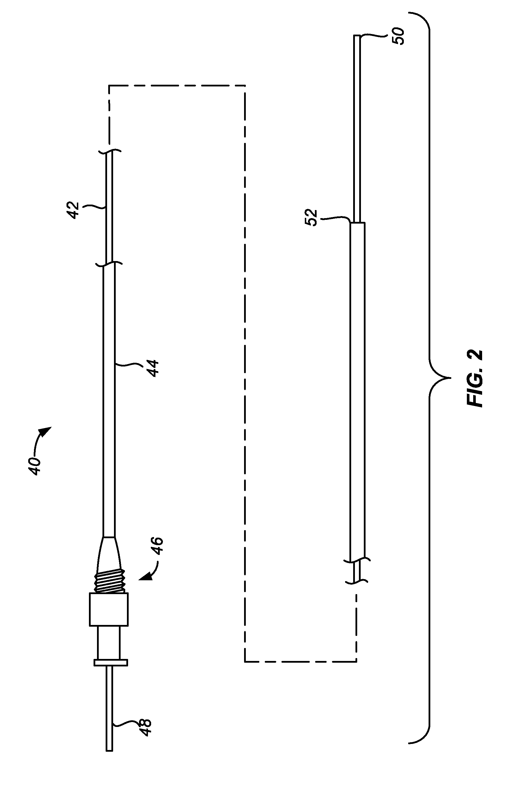 Ureteral stent and method and system for its deployment