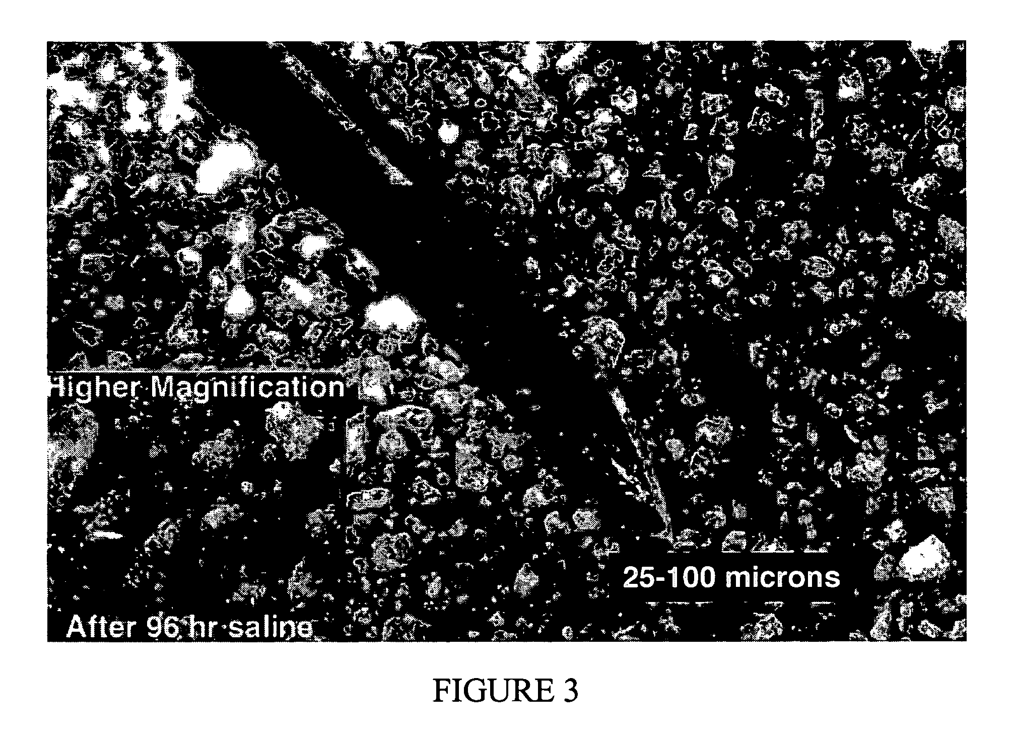 Biocompatible protein particles, particle devices and methods thereof