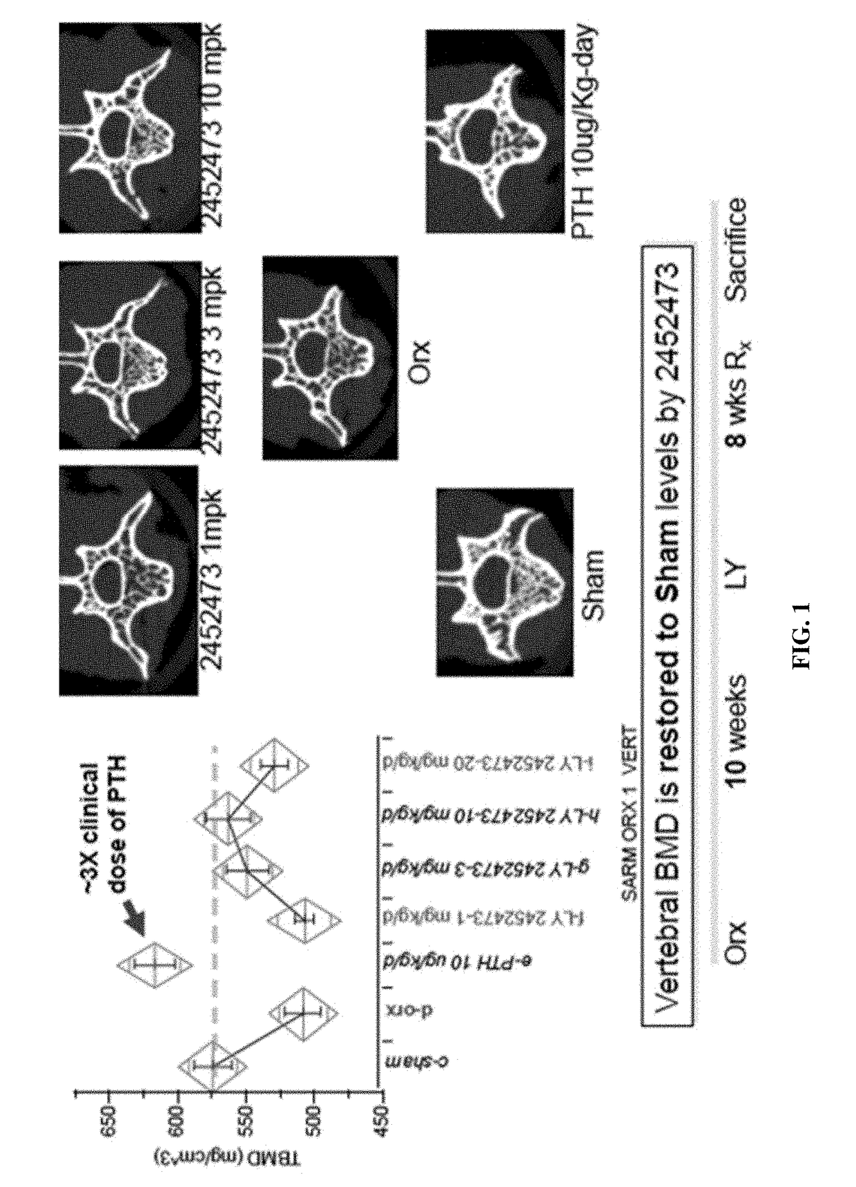 Tetrahydrocyclopenta[b]indole compounds and phosphodiesterase inhibitors for the treatment of the signs and symptoms of bhp