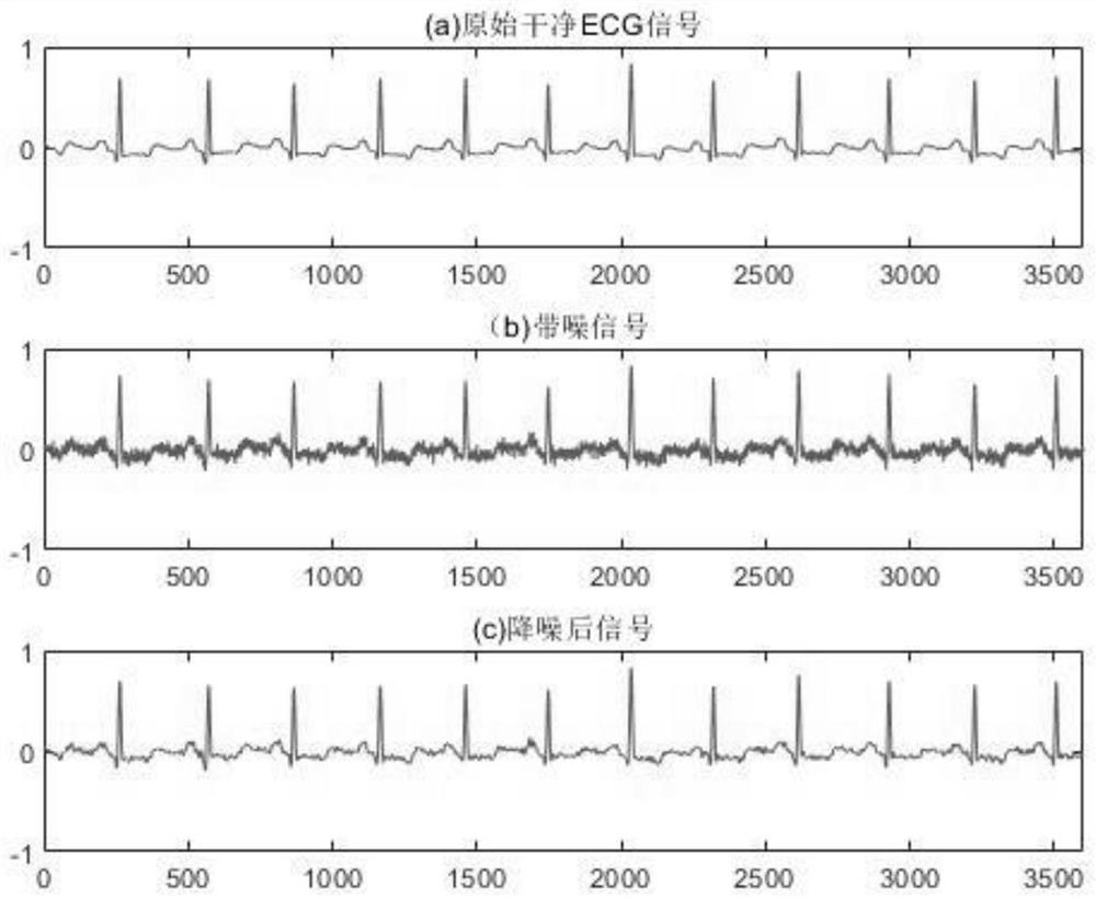 Improved electrocardiosignal noise reduction method based on singular spectrum analysis