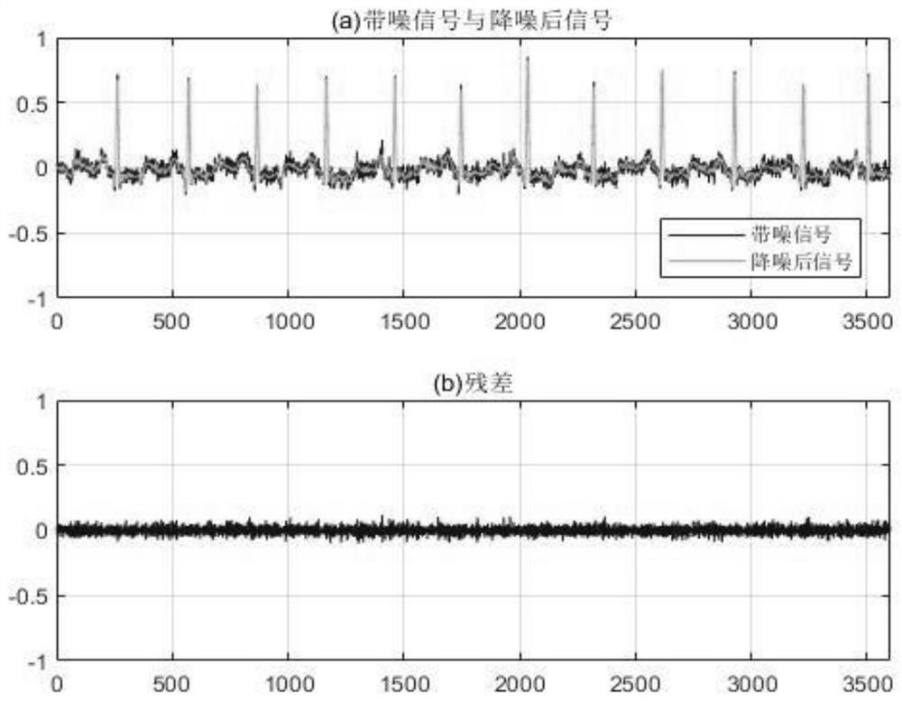 Improved electrocardiosignal noise reduction method based on singular spectrum analysis