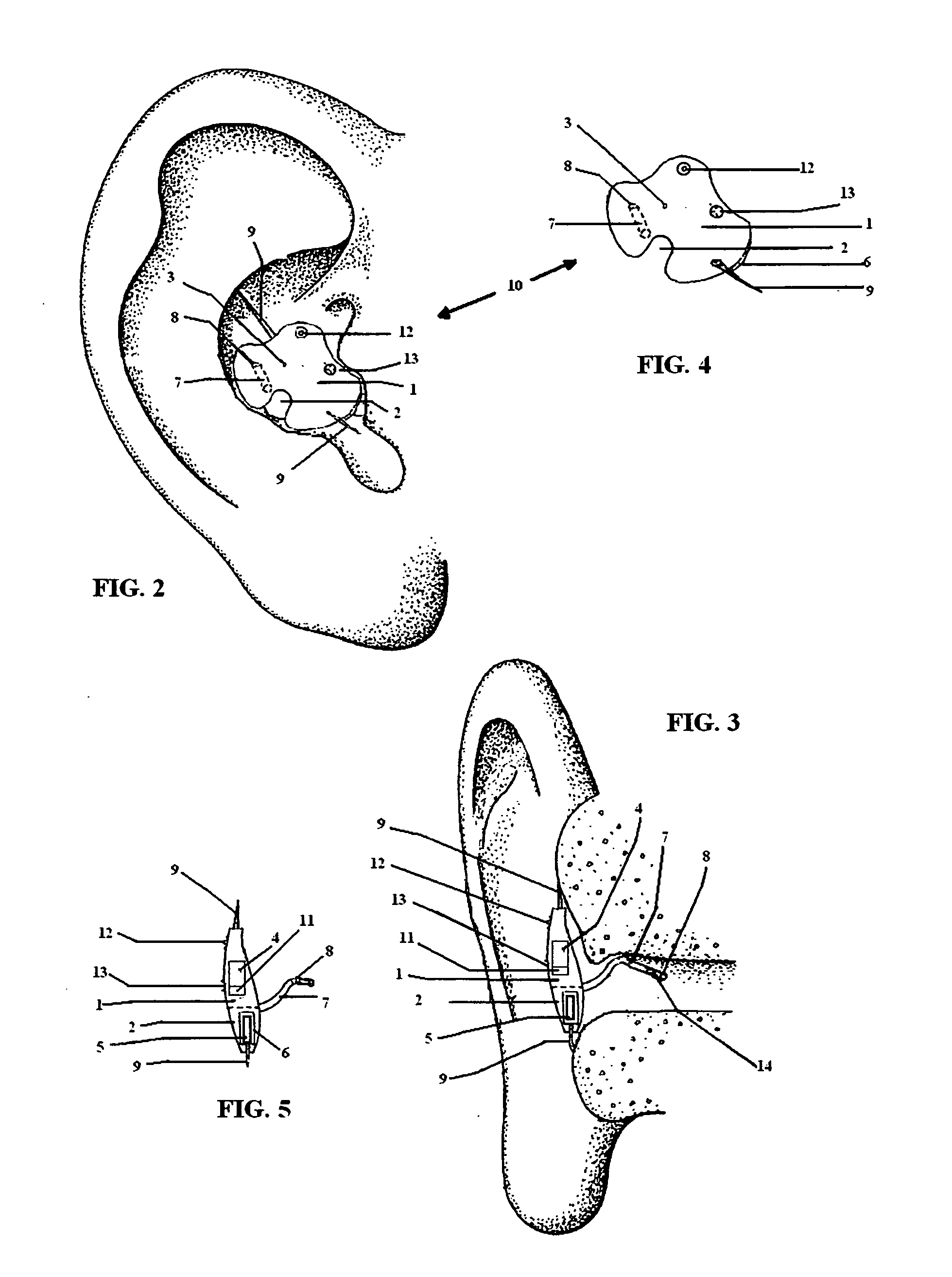 Concha bowl hearing aid apparatus and method