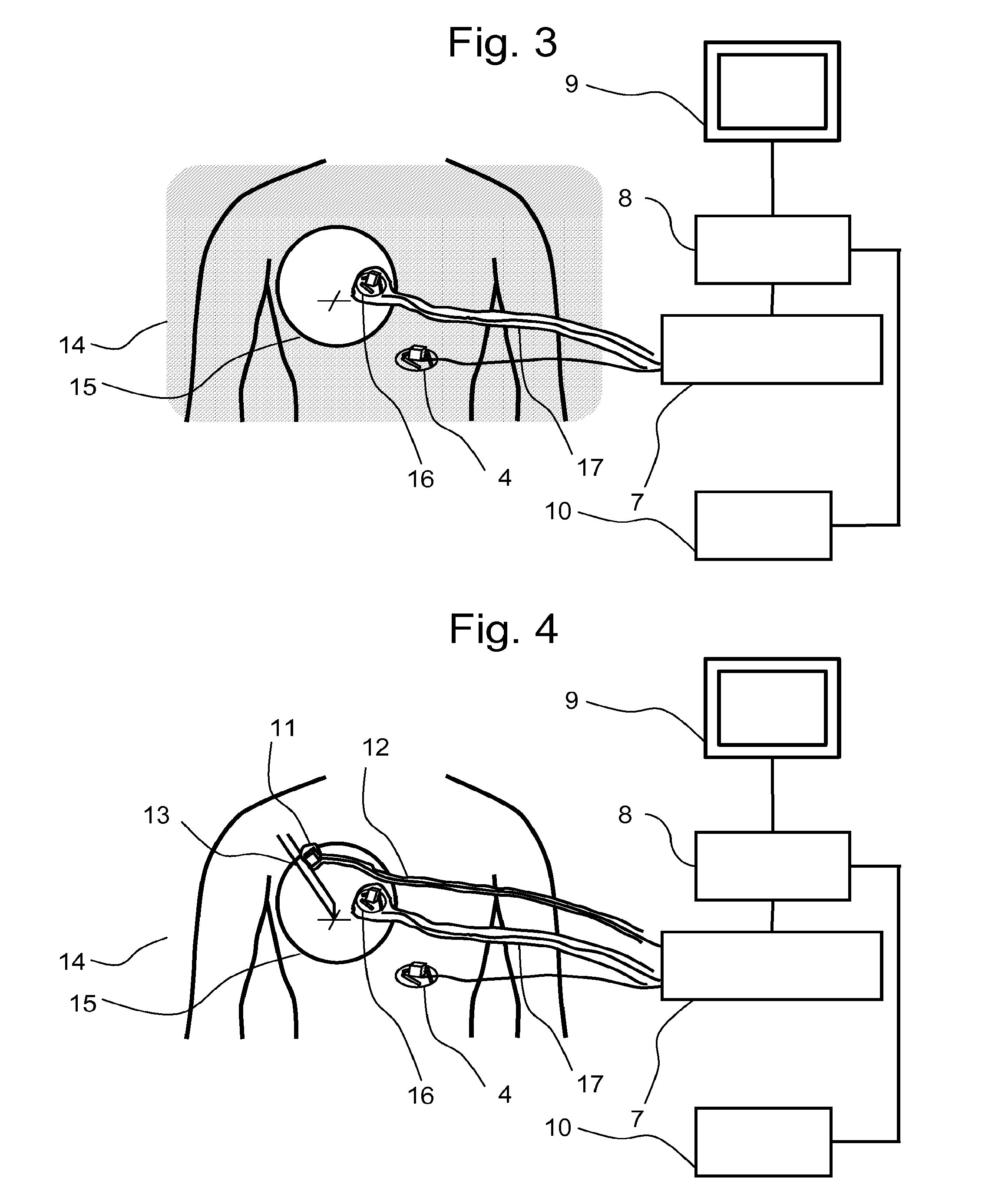 Method and device for navigation of a surgical tool