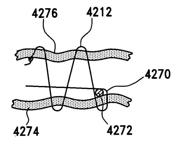 Method for suture lacing