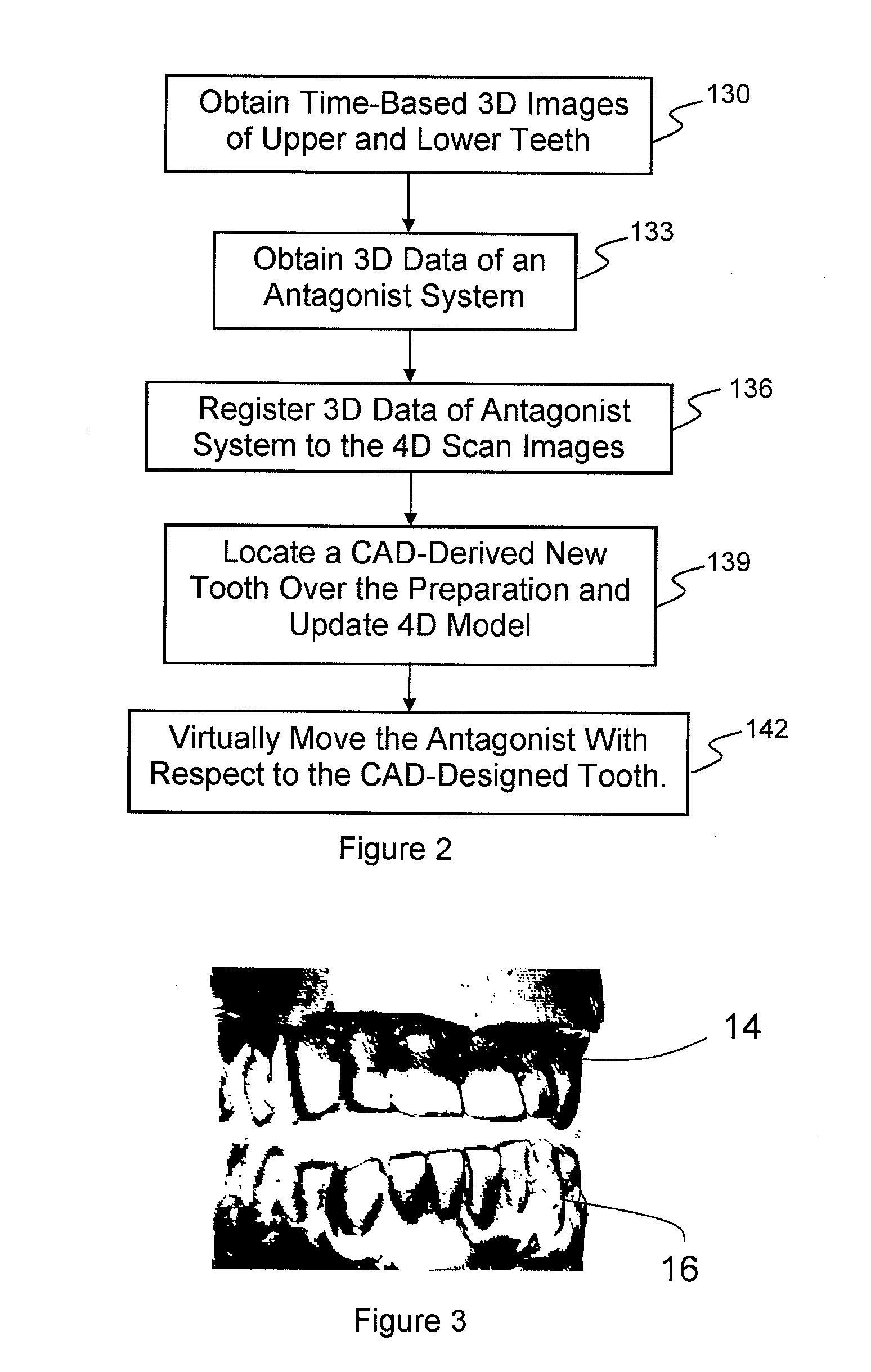 Method Of Designing Dental Devices Using Four-Dimensional Data