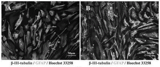 A culture medium for promoting the differentiation of rat neural stem cells and its application method