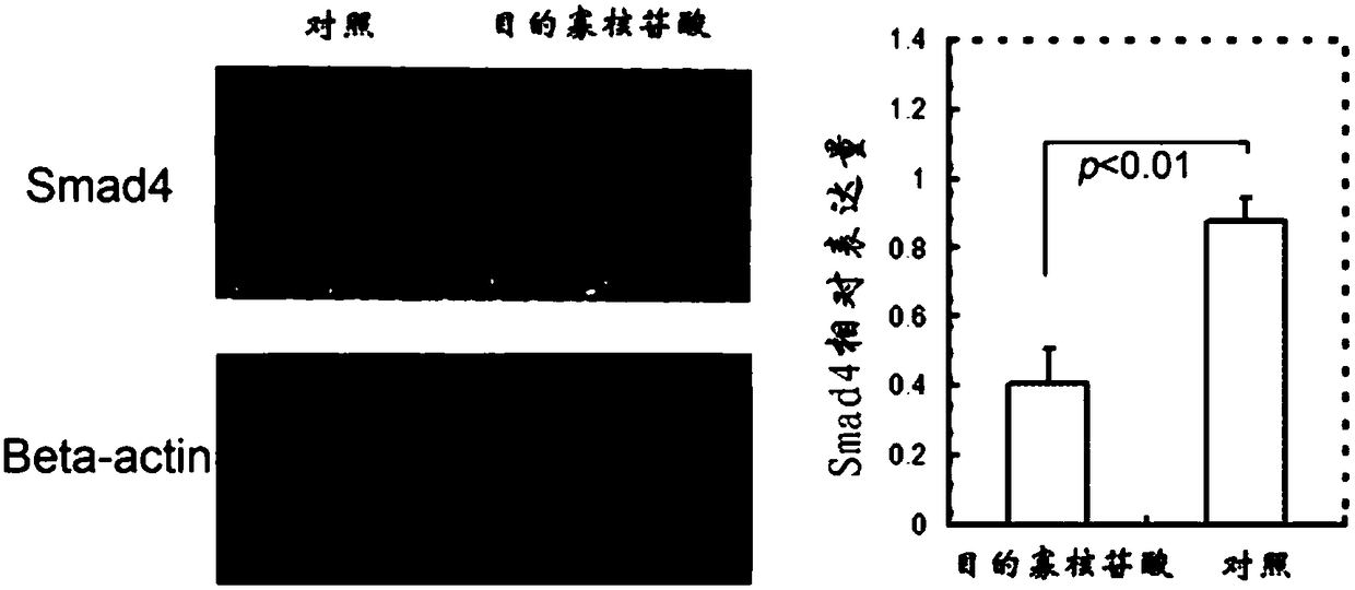 Oligonucleotide for promoting repair of skeletal muscle injury, medicine and application thereof