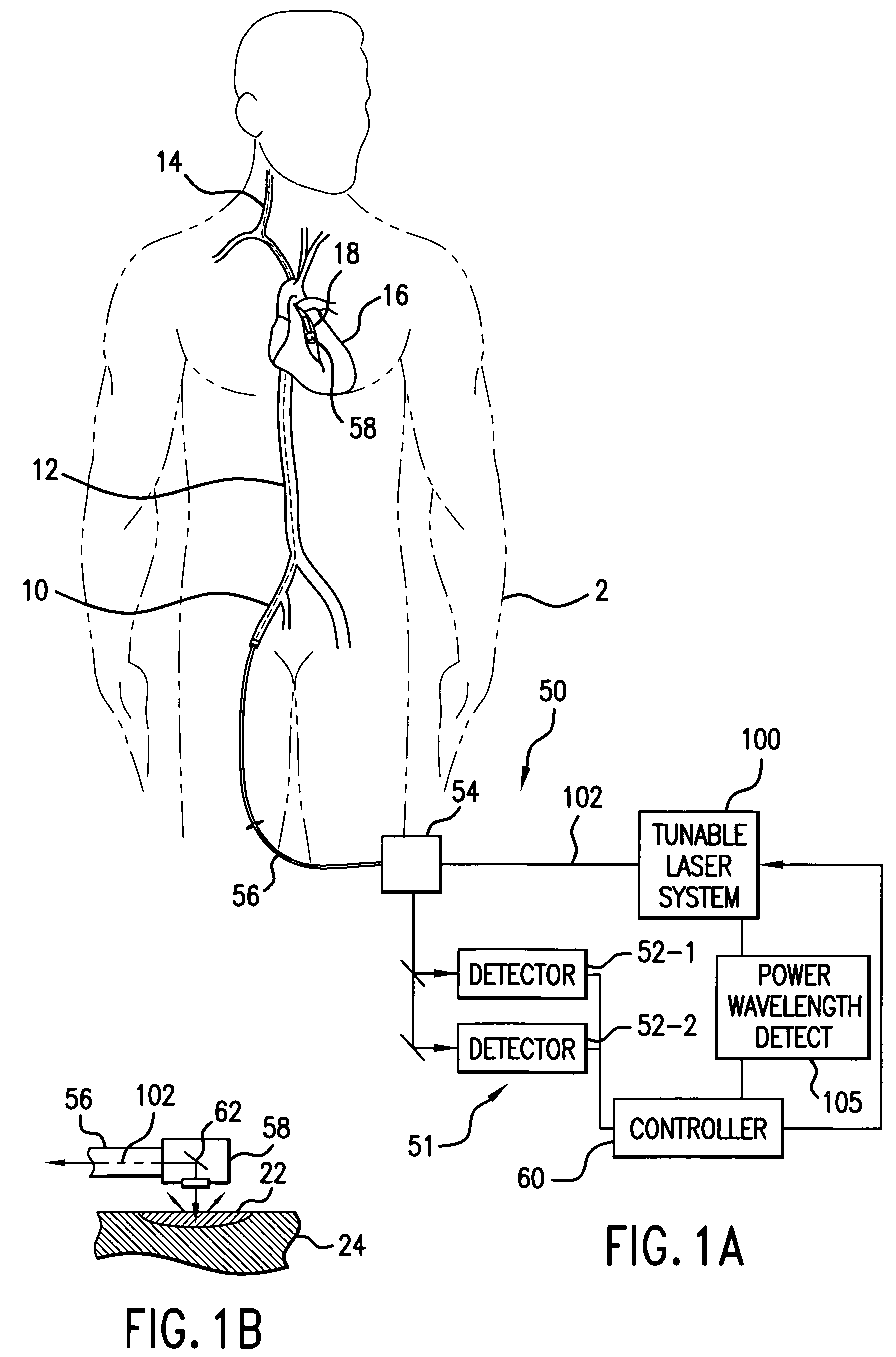Spectroscopic catheter system with widely tunable source and method of operation